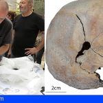 Encuentra en Gran Canaria restos de 12 personas y cráneos con impacto de bala de la Guerra Civil
