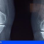 El Hospital de El Hierro realiza por primera vez una cirugía de rodilla por rotura de ligamento