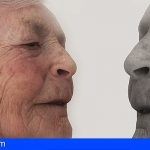 Dr. Agustín Viera: “El 90% de las personas mayores de 60 años tiene manchas en la piel”
