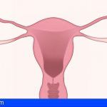 Canarias implantará a partir de enero el cribado poblacional del cáncer de cérvix, al igual que ocurre con el de mama