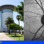 Tenerife | Un acuerdo permitirá identificar con mayor precisión enfermedades de retina y nervio óptico
