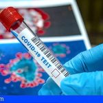 Canarias autoriza a 33 laboratorios y empresas ajenos al SCS para pruebas de COVID-19