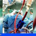 Canarias | 36 donantes de órganos han permitido realizar 62 trasplantes durante estos 5 meses