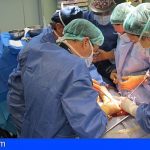 Canarias bate récord de trasplantes de órganos al realizar 196 a lo largo de 2020
