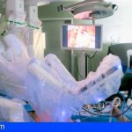 El Hospital de La Candelaria realiza 85 intervenciones quirúrgicas con cirugía robótica
