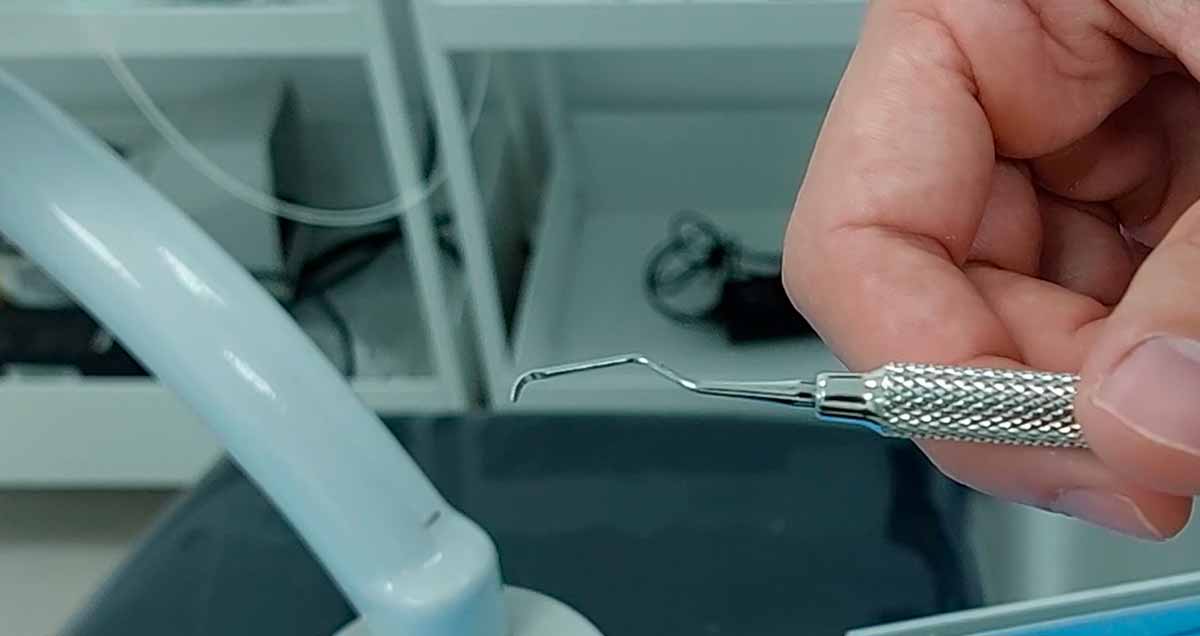 Cureta periodontal, utilizada en procedimientos de raspado