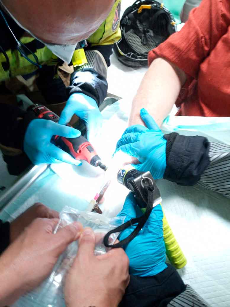 Bomberos de Tenerife colaborando con el personal de Urgencias del Hospital Universitario de Canarias (HUC) para extraer un anillo a un paciente