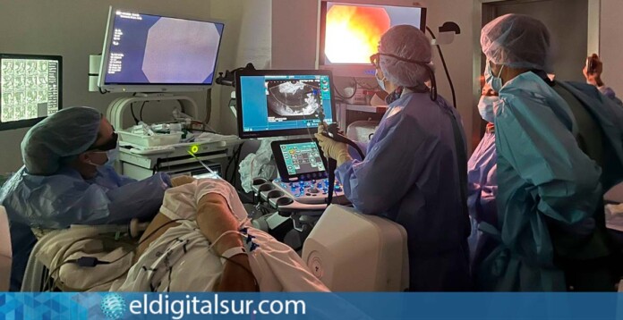 Especialistas del HUNSC durante una gastroyeyunostomía por ecoendoscopia