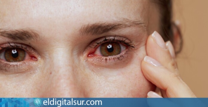 como quitar ojos hinchados por llorar